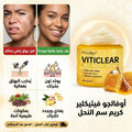 كريم علاج البهاق VITICLEAR