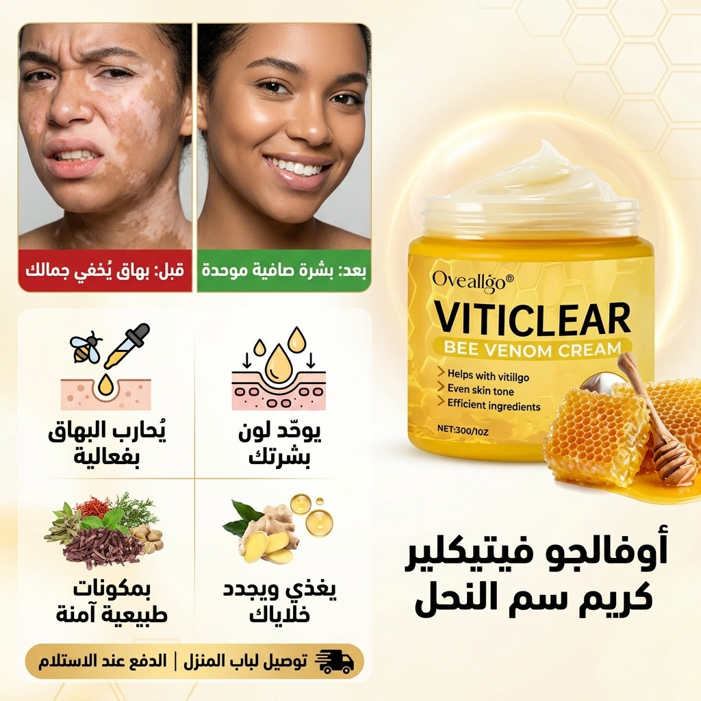 كريم علاج البهاق VITICLEAR