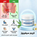 كريم سيفيروز لعلاج البواسير