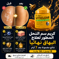 كريم علاج البهاق VITICLEAR