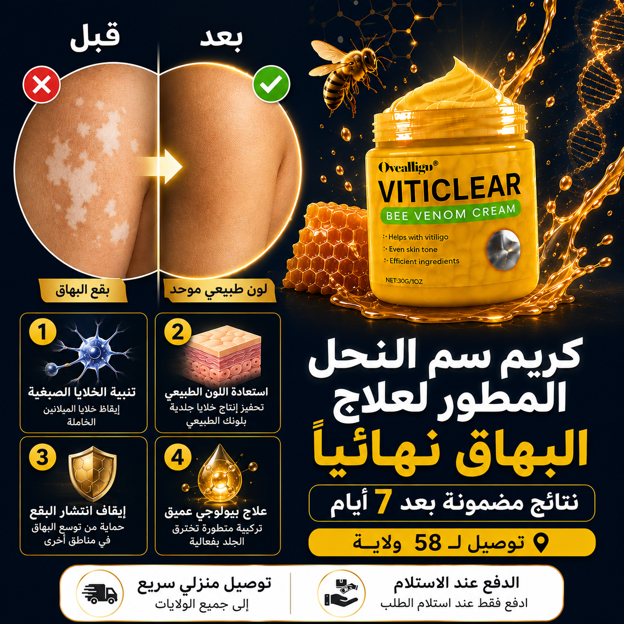 كريم علاج البهاق VITICLEAR