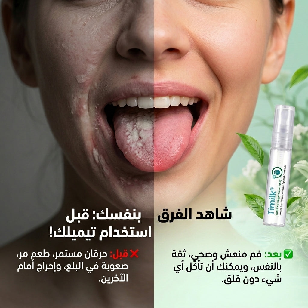 بخاخ Timilk لعلاج فطريات الفم
